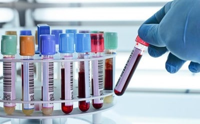 Blutprobe für ganzheitliche Analyse
